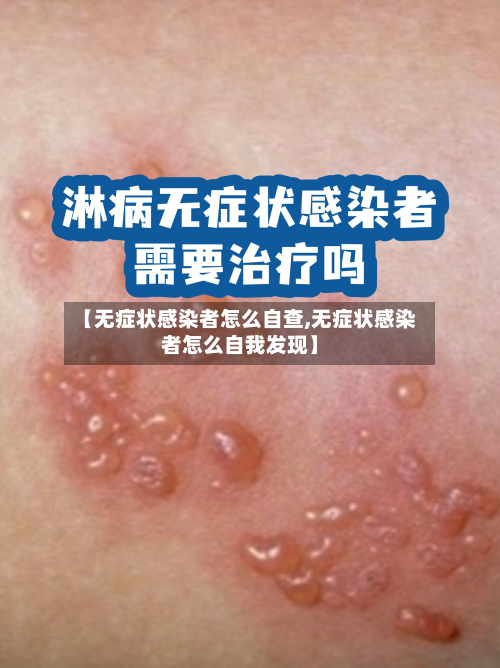【无症状感染者怎么自查,无症状感染者怎么自我发现】