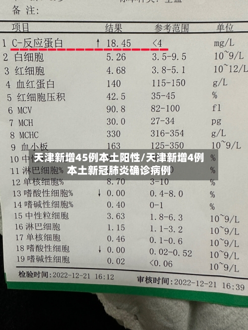 天津新增45例本土阳性/天津新增4例本土新冠肺炎确诊病例-第3张图片