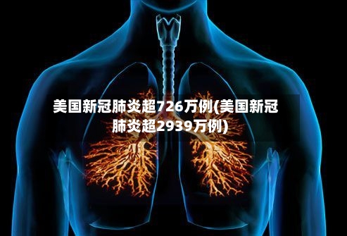 美国新冠肺炎超726万例(美国新冠肺炎超2939万例)-第1张图片