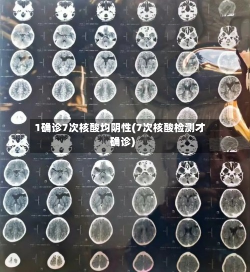 1确诊7次核酸均阴性(7次核酸检测才确诊)-第1张图片