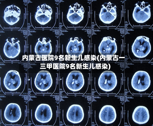 内蒙古医院9名新生儿感染(内蒙古一三甲医院9名新生儿感染)-第1张图片