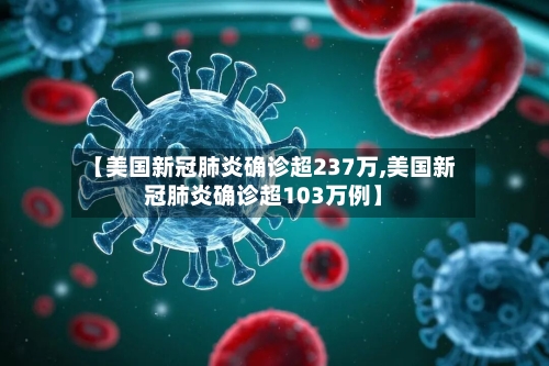 【美国新冠肺炎确诊超237万,美国新冠肺炎确诊超103万例】-第2张图片