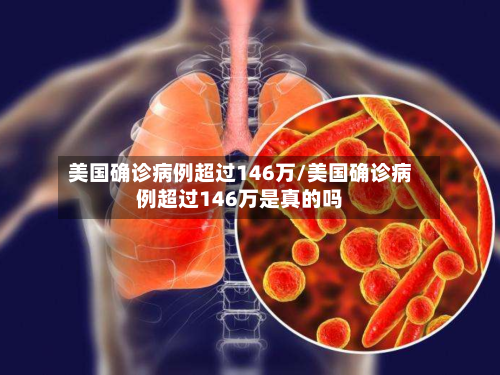 美国确诊病例超过146万/美国确诊病例超过146万是真的吗