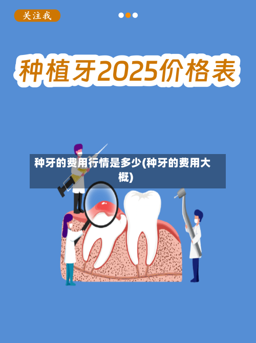 种牙的费用行情是多少(种牙的费用大概)