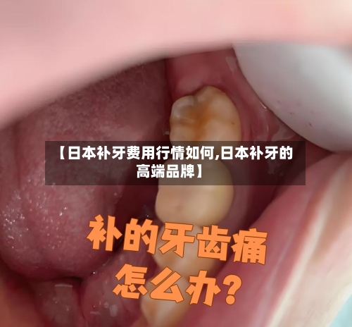【日本补牙费用行情如何,日本补牙的高端品牌】-第1张图片