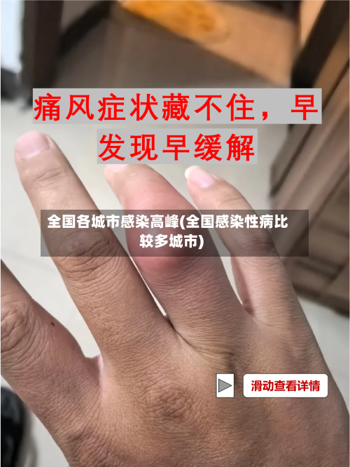 全国各城市感染高峰(全国感染性病比较多城市)-第1张图片