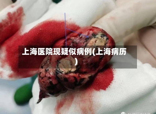 上海医院现疑似病例(上海病历)-第2张图片