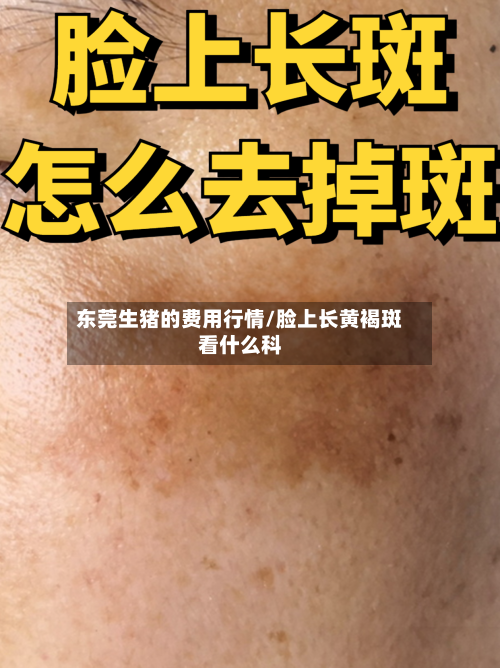 东莞生猪的费用行情/脸上长黄褐斑看什么科-第3张图片