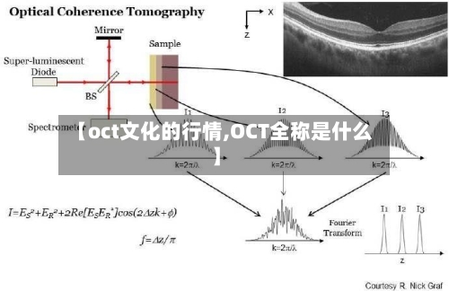 【oct文化的行情,OCT全称是什么】-第1张图片