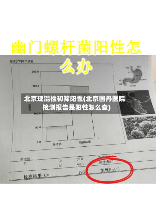北京现混检初筛阳性(北京国丹医院检测报告是阳性怎么查)-第1张图片