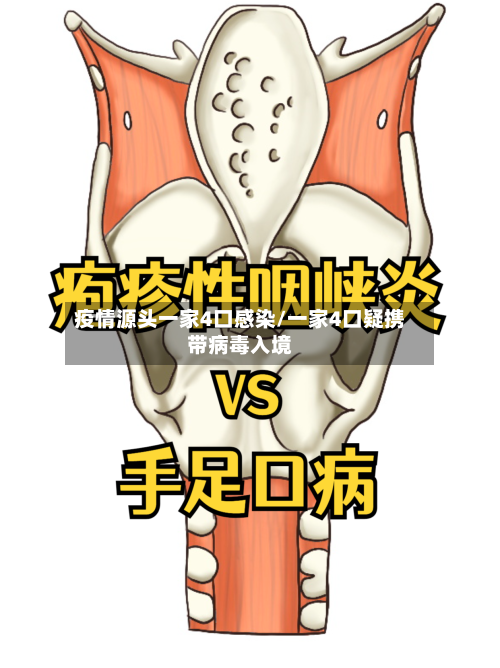 疫情源头一家4口感染/一家4口疑携带病毒入境-第1张图片
