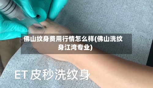 佛山纹身费用行情怎么样(佛山洗纹身江湾专业)-第1张图片