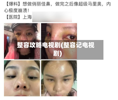 整容攻略电视剧(整容记电视剧)-第2张图片