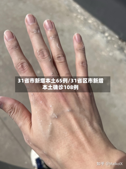 31省市新增本土65例/31省区市新增本土确诊108例-第2张图片