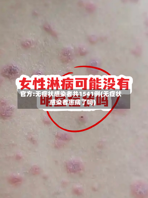官方:无症状感染者共1541例(无症状感染者患病了吗)-第3张图片