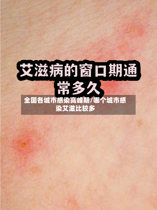 全国各城市感染高峰期/哪个城市感染艾滋比较多-第1张图片