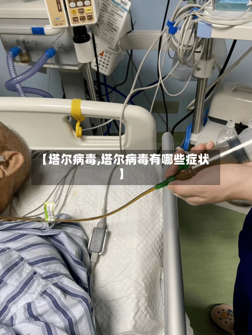 【塔尔病毒,塔尔病毒有哪些症状】-第3张图片